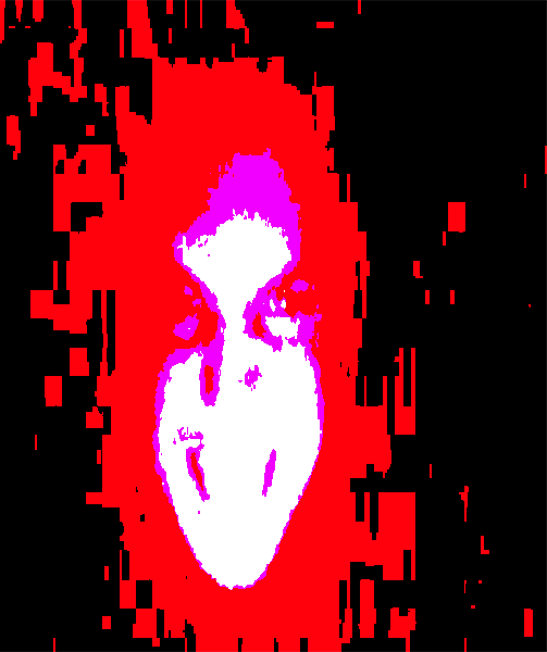 M E